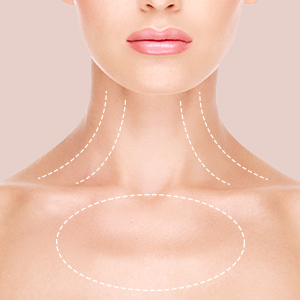 Ultraprime-treatment-areas_decolletage