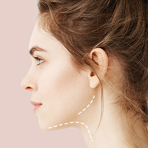 UltraPrime-treatment-areas_Chin