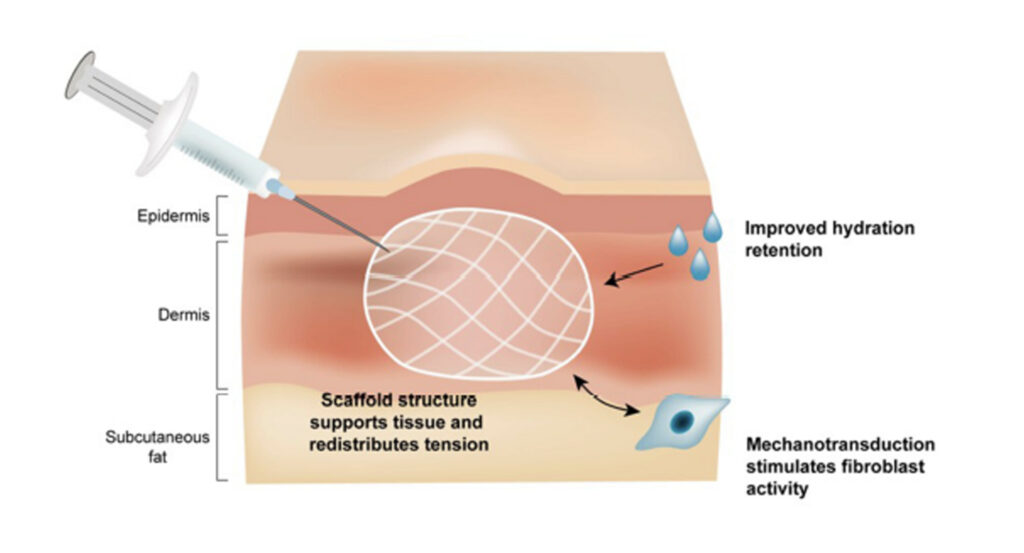 Rejuran Treatments Melbourne