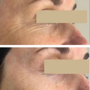 Before-and-After-1-300x300