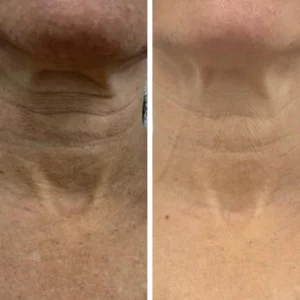 Before-and-After-2-300x300