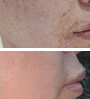 Before-and-After-4