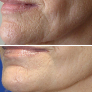 Before-and-After-7-300x300