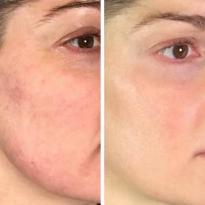 Before-and-After-9-300x300