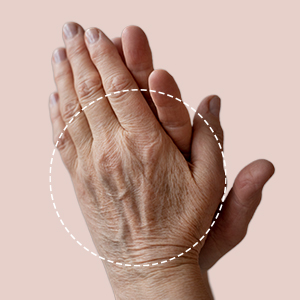 Exomes-treatment-areas_hand